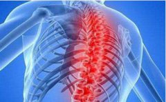 强直性脊柱炎的护理是什么