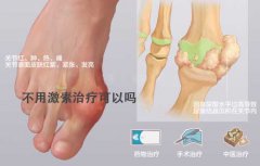 广州长安医院：痛风患者身体出现4个表现要警惕